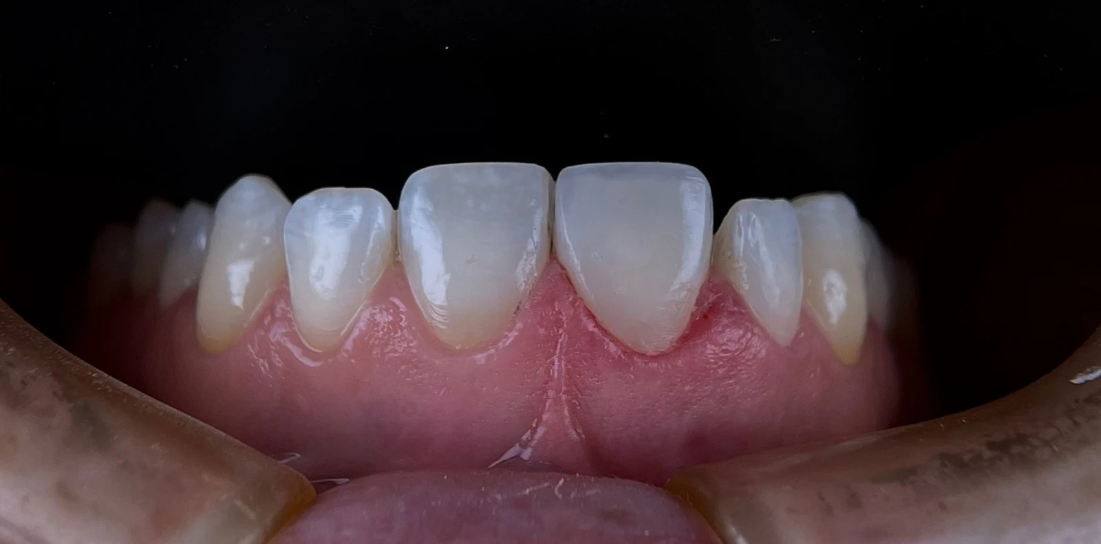 Estética dental